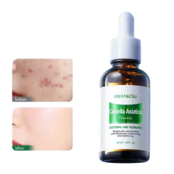 FAYANKOU CENTELLA ASIATICA REPAIRING SERUM 30 ML