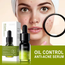 HUNMUI INTENSE ANTI-ACNE FACE SERUM 10ML