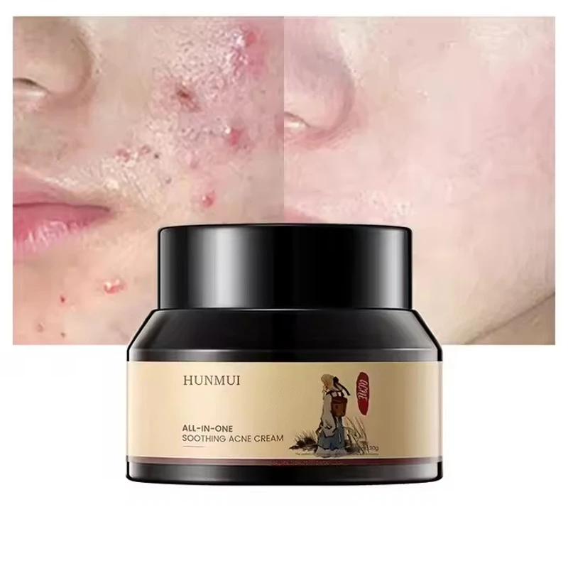 HUNMUI ANTI ACNE CREAM 30 G