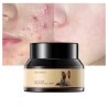 HUNMUI ANTI ACNE CREAM 30 G